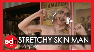 Meet the man with the worlds stretchiest skin  WEIRD [upl. by Caria377]