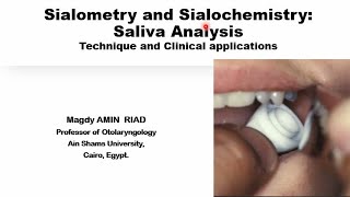 Sialometry and Sialochemistry Saliva analysis [upl. by Drugge336]