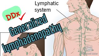 Approach to Diagnosing Generalized Lymphadenopathy [upl. by Michaela703]