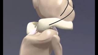 Cranial Cruciate Ligament Rupture  3D Animation for Veterinary Undergraduates [upl. by Farika284]