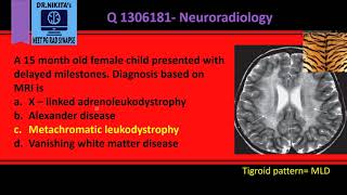 Metachromatic leukodystrophy Tigroid pattern [upl. by Bravar]