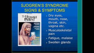 Sjogrens Syndrome Beyond Dry Eyes and Mouth by Frederick Vivino MD [upl. by Oinotla]