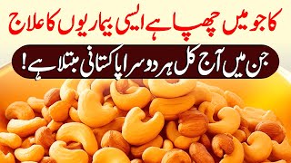 Benefits Of Cashew For Diabetes And Weight Loss Urdu Hindi  Kaju Khane K Fayde [upl. by Renate106]