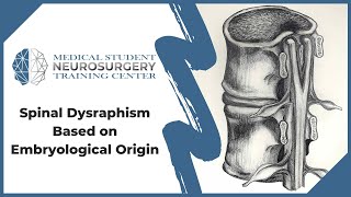 Spinal Dysraphism Based on Embryological Origin [upl. by Nennerb]