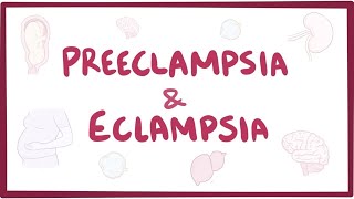 Preeclampsia amp eclampsia  causes symptoms diagnosis treatment pathology [upl. by Nothgiel]