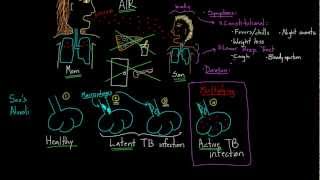 Symptoms and Spread of Tuberculosis [upl. by Carol-Jean]