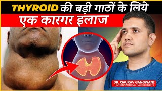 Effective Treatment For Multinodular Goitre  Thyroid Artery Embolisation  Dr Gaurav GangwaniIR [upl. by Darsie]