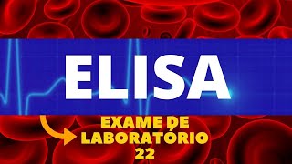 TESTE DE ELISA EXAME DE ELISA  IMUNOLOGIA PASSO A PASSO  EXAMES DE LABORATÓRIO [upl. by Anallese]