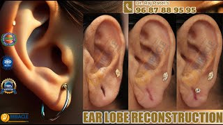 Ear Lobe Repair  Ear Holl Repair  Torn Ear Repair  Ear Pasting Lotion Available Call  9687889595 [upl. by Gnuhp879]