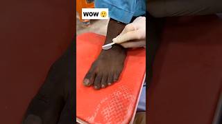 Dark Feet Cleaning Tips 💯Most Easy Pedicure ✅Get Fair Feet 👣 pedicure skincare ytviral shorts [upl. by Leerzej541]