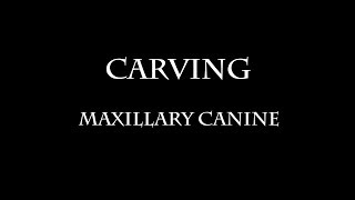 Carving Maxillary Canine [upl. by Akimet]