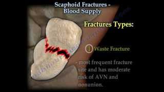 Scaphoid Fractures Blood Supply  Everything You Need To Know  Dr Nabil Ebraheim [upl. by Aihsit]