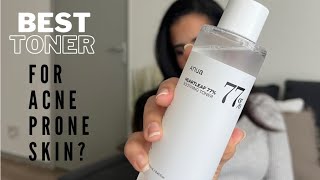 Anua Heartleaf 77 HONEST REVIEW  Before amp After [upl. by Ylac]