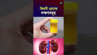 কিডনী রোগে যেসব লক্ষণ দেখা যায় । Symptomps of kidney disease [upl. by Neerehs743]