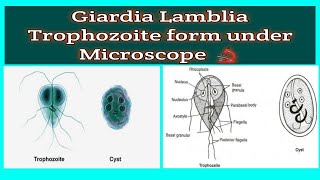 shorts  Giardia Lamblia Trophozoite form under Microscope 🔬 during Stool examination [upl. by Ahsiket732]