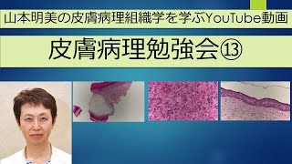 皮膚病理勉強会 第13回 [upl. by Raye]