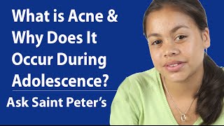 What is Acne and Why Does It Occur During Adolescence [upl. by Assirolc495]