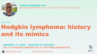 Hodgkin Lymphoma history and its mimics [upl. by Dole866]