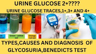 GLUCOSE SUGAR IN THE URINEBENEDICTS TESTGLUCOSE OXIDASE REAGENT STRIPSGLUCOSE 1GLUCOSE TRACES [upl. by Iramohs]