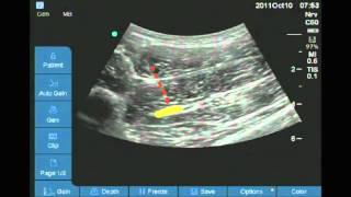 Macleods examination of the optic II oculomotor III trochlear IV and abducens VI nerves [upl. by Harifaz]