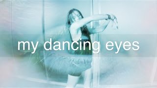 My Dancing Eyes  Nystagmus [upl. by Nitsej810]