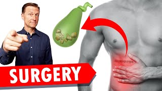 Gallbladder Surgery Removal WATCH THIS [upl. by Eiten]