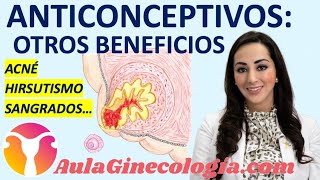 ANTICONCEPTIVOS OTROS BENEFICIOS DOLOR SANGRADO CÁNCER Ginecología y Obtetricia [upl. by Siahc]