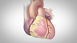 Coronary Artery Bypass Surgery [upl. by Kalin511]