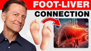 How Your Feet Are Warning You About Your Liver Problems  Dr Berg Explains [upl. by Brana]