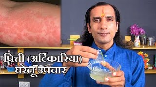 पित्ती का इलाज  pitti ka ilaj  How To Cure Urticaria  Urticaria Treatment [upl. by Stacie64]