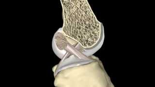 The ACL During Knee Range of Motion [upl. by Ddal]