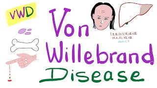 Von Willebrand Disease VWD  The Most COMPREHENSIVE Explanation [upl. by Adnac]