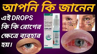 CIPLOX EYE DROPS USE IN BANGLA চোখের যাবতীয় সমস্যার এই ড্রোপস ব্যাবহার করুন। [upl. by Atiuqam]