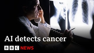 AI tool spots cancers missed by doctors  BBC News [upl. by Eirrej932]