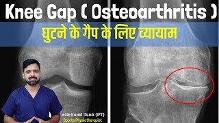 Knee gap exercises in hindi  exercise for knee pain  knee osteoarthritis pain  Dr Sunil Tank [upl. by Kizzie369]