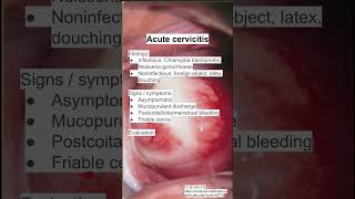 Acute cervicitis [upl. by Enomas45]