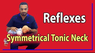 07 Symmetrical Tonic Neck Reflex [upl. by Howlond]