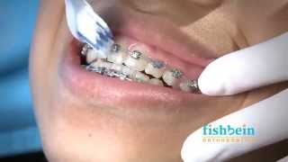 Orthodontic Home Care Instructions  Braces  Brushing [upl. by Brieta]