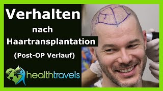 Verhalten nach Haartransplantation PostOP Verlauf  Health Travels informiert [upl. by Yeldah]