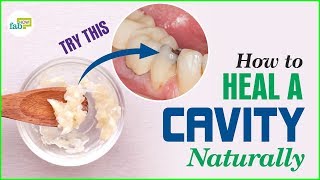 How to Get Rid of Cavities Heal and Reverse [upl. by Hairakcaz436]