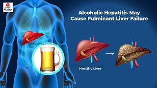 What is Fulminant Hepatitis  Fulminant Hepatic Failure  Hepatitis [upl. by Nahsar]