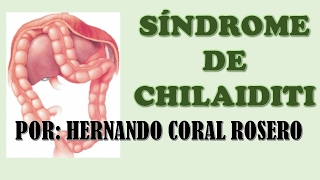 SÍNDROME DE CHILAIDITI INTERPOSICIÓN DEL INTESTINO ENTRE EL HÍGADO Y EL DIAFRAGMA [upl. by Nealy315]