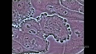 Mitosis in an animal cell Under the Microscope [upl. by Spurgeon]