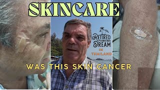 Warning signs of skin cancer Dont ignore these [upl. by Phylys312]