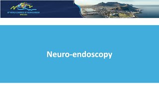 Neuroendoscopy [upl. by Avle]