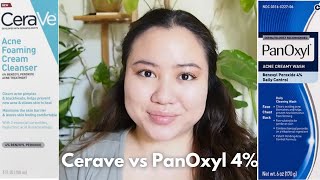 PanOxyl vs Cerave Benzoyl Peroxide 4 Cleanser [upl. by Refinnej813]