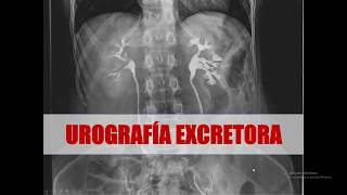 UROGRAFIA EXCRETORA FISIOLOGIA Y REALIZACION [upl. by Annoyt]