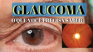 GLAUCOMA o que é e quais os seus sintomas  Dr André Wambier [upl. by Hadik155]