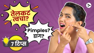 Acne Spot Removal  Oily Skin Moisturizer  Pimples Treatment at Home  Acne Scars Urmila Nimbalkar [upl. by Osbourne]