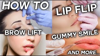 How To Inject Botox  Frown Forehead Brow Lift Gummy Smile and Lip Flip [upl. by Fradin]